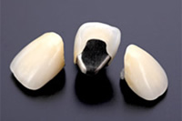 メタルボンドクラウン