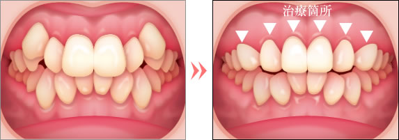 ビフォーアフター