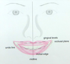 デザインのこだわり