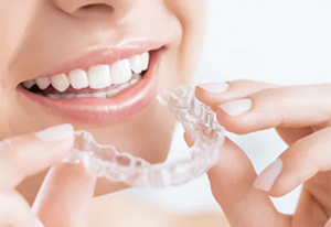 マウスピース矯正